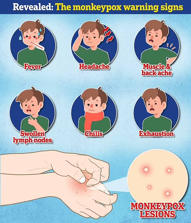 What are the Symptoms of Monkeypox?