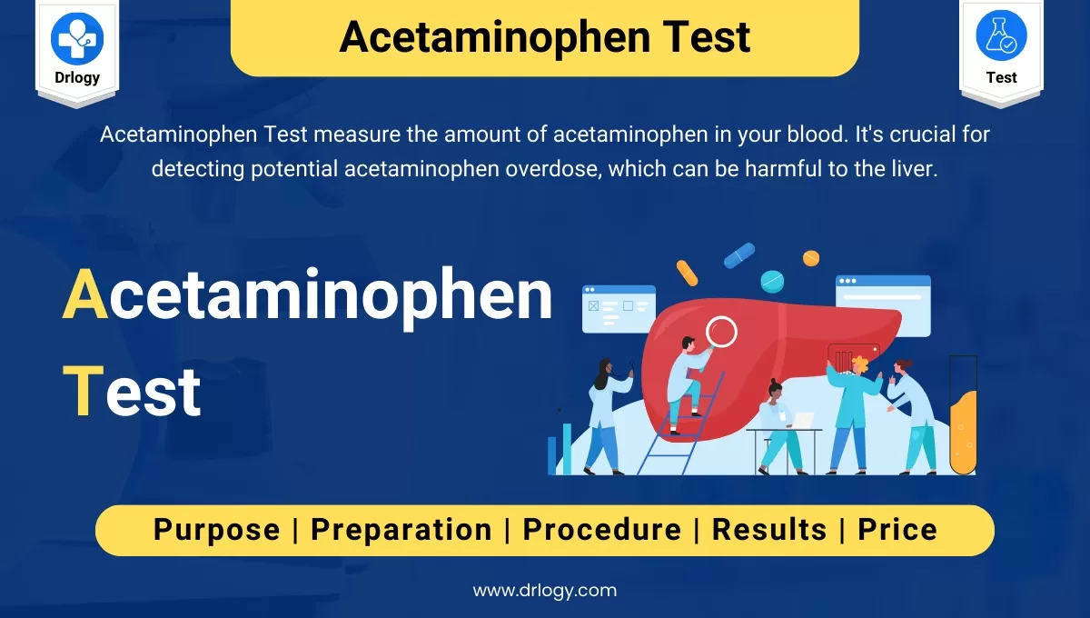 Acetaminophen Test To Detect Acetaminophen Overdose