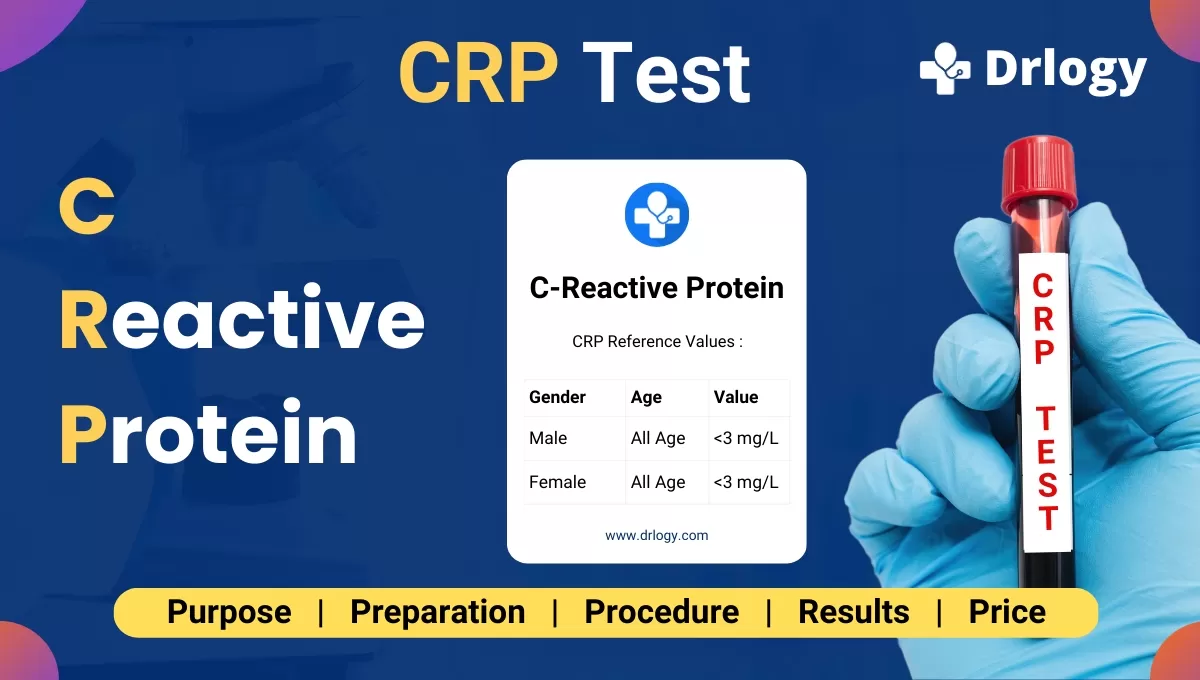 C Reactive Protein CRP Test Introduction Principle 46 OFF