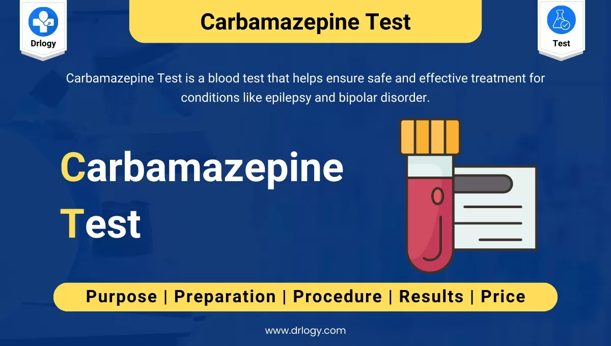 Carbamazepine Test To Monitor Blood for Therapeutic Drug Levels