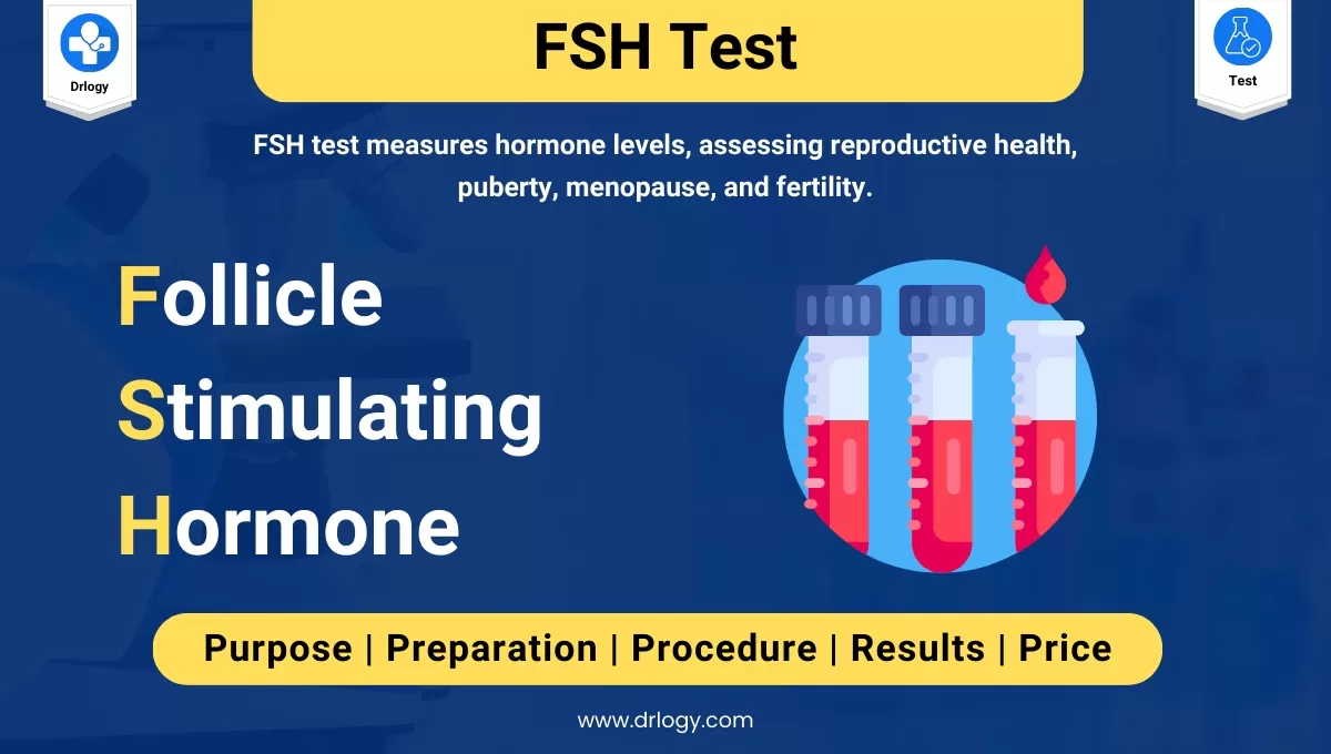 FOLLICLE STIMULATING HORMONE FSH LEVELS TEST Medical 48 OFF