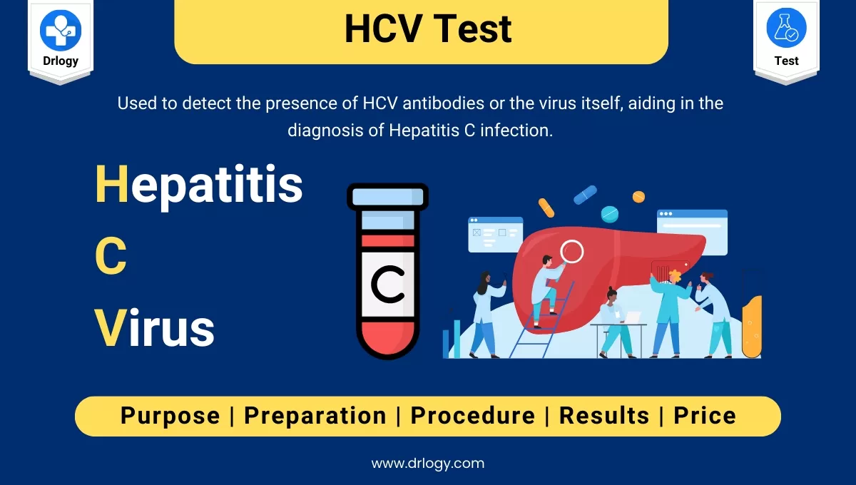 Hepatit﻿is C Virus (HCV) Test For Detection of Virus Infection