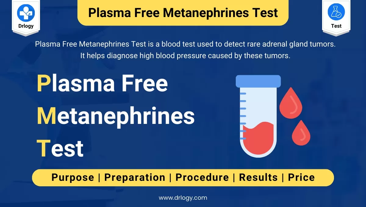 Plasma Free Metanephrines Test: Price Purpose Results Drlogy Plasma Free Metanephrines Test: Price Purpose Results Drlogy