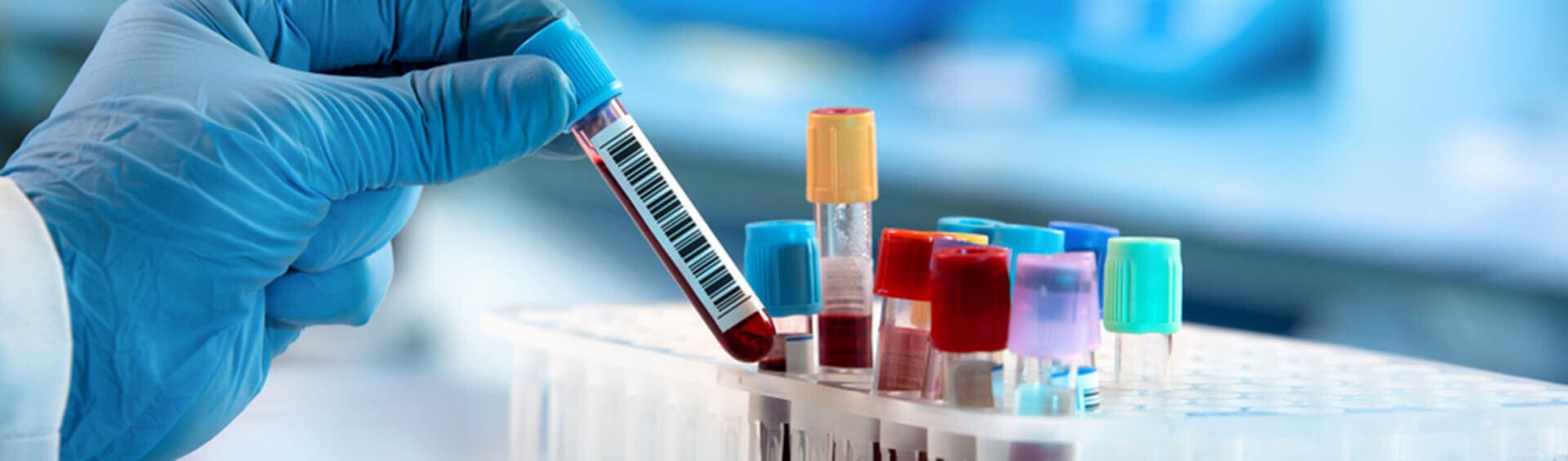 RE LIFE LABORATORY Images/Photos, Bank Colony, Bidar