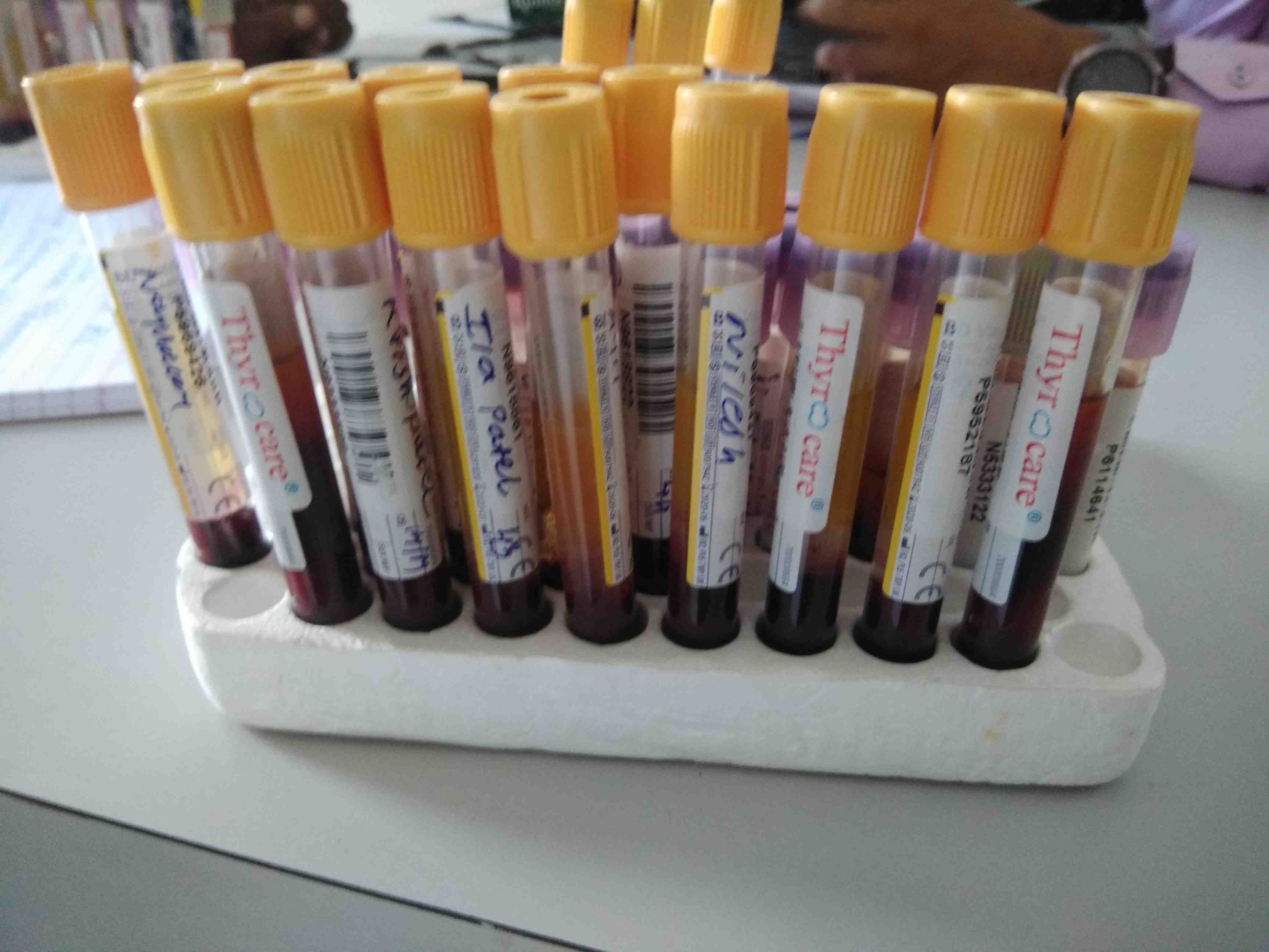 Thyrocare Lab Images/Photos, New jagnath, Rajkot