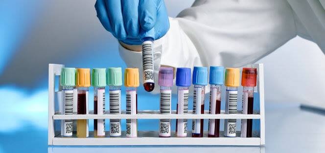 RE LIFE LABORATORY Images/Photos, Bank Colony, Bidar