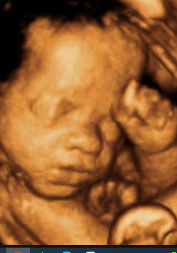 New Raj X-Ray, Ultrasound And CT Scan Center Images/Photos, BHAISASUR, Nalanda New Raj X-Ray, Ultrasound And CT Scan Center Images/Photos, BHAISASUR, Nalanda