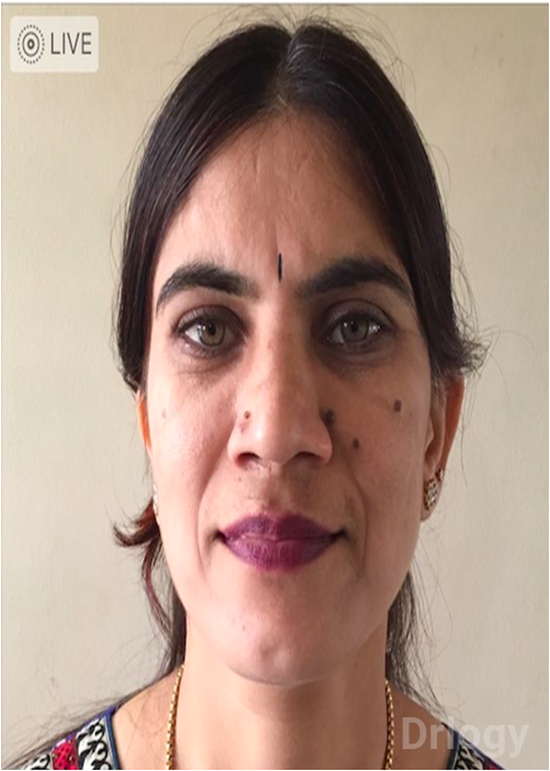 Dr. Annapoorna.P.M in Bangalore