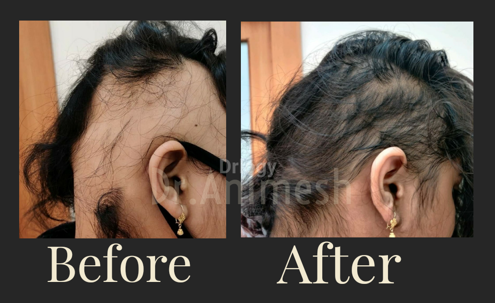 Rejuva Clinic Images/Photos, Padmanabh nagar,Subhash nagar, Bhopal