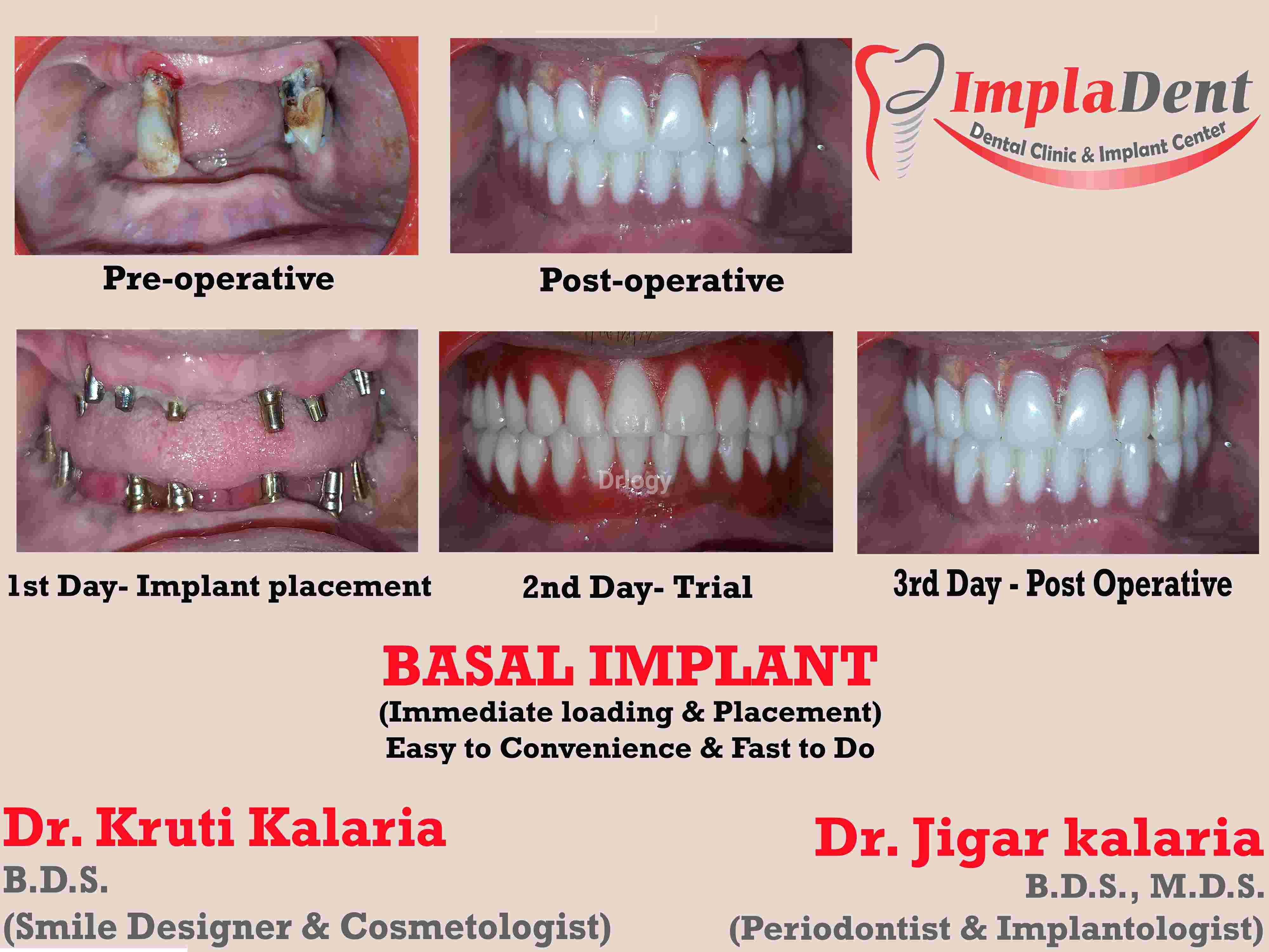IMPLADENT Dental Clinic & Implant Center Images/Photos, Amin Marg, Rajkot