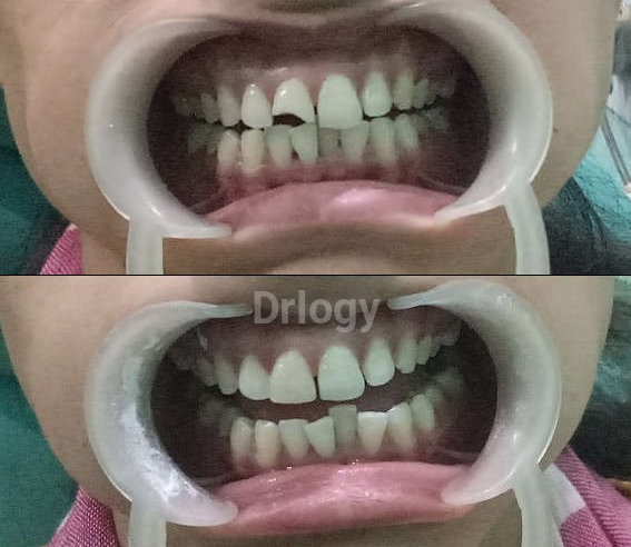 Magadh Oro Dental Images/Photos, Kankarbagh, Patna
