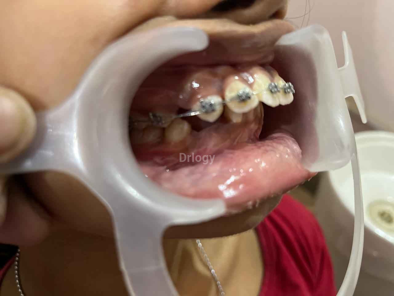 Align Dental & Braces Superspeciality Centre Images/Photos, Sheikhpura, Patna