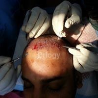 Radiance Hair & Skin Laser Centre Images/Photos, Pal Road, Jodhpur