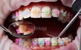 Align Dental Clinic Images/Photos, Udaipur, Udaipur