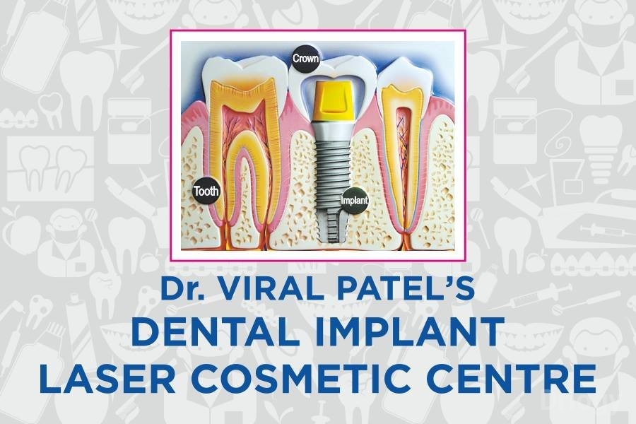 Dental Implant Laser Cosmetic Centre Images/Photos, Nava Vadaj, Ahmedabad
