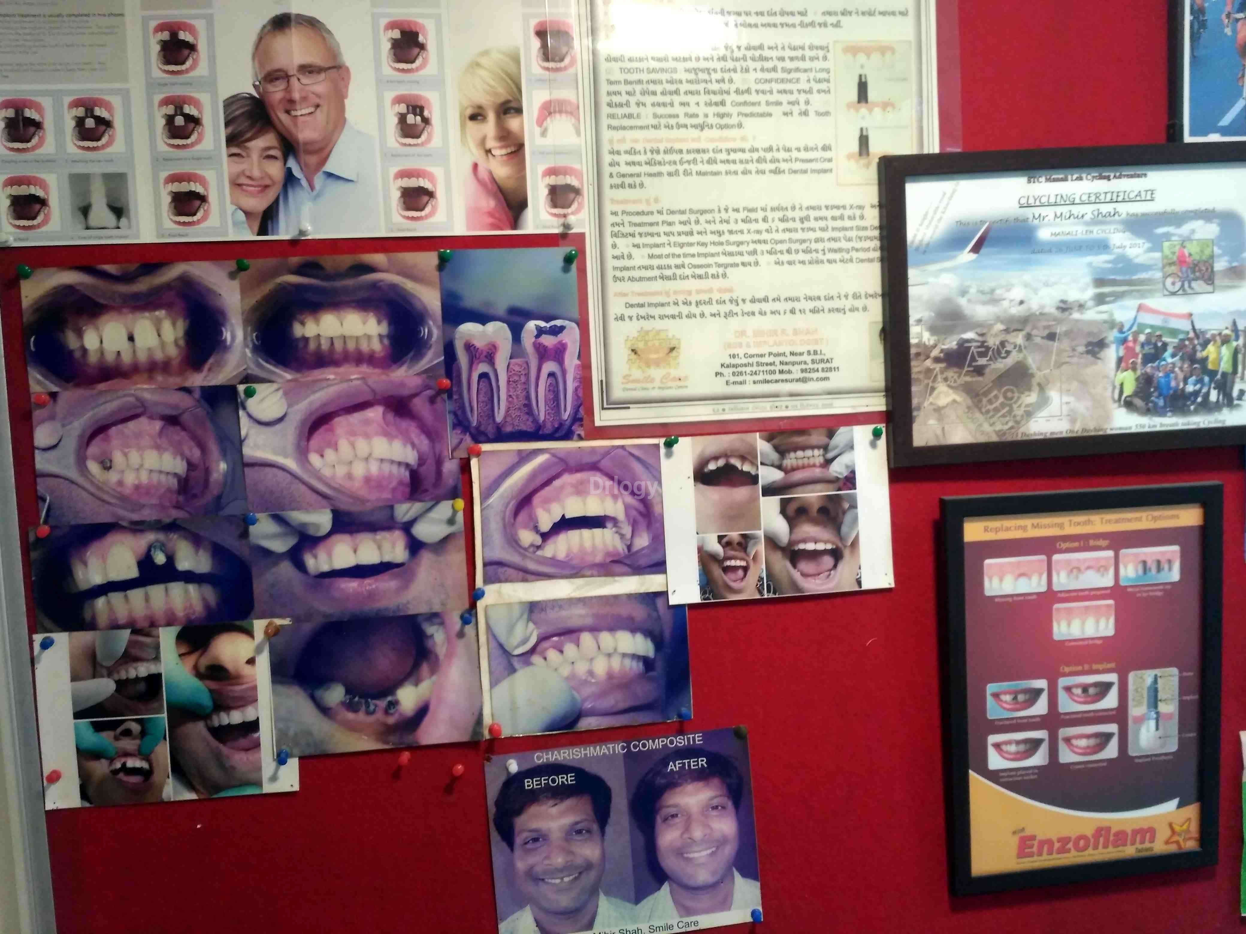 Smile Cure Images/Photos, Nanpura, Surat