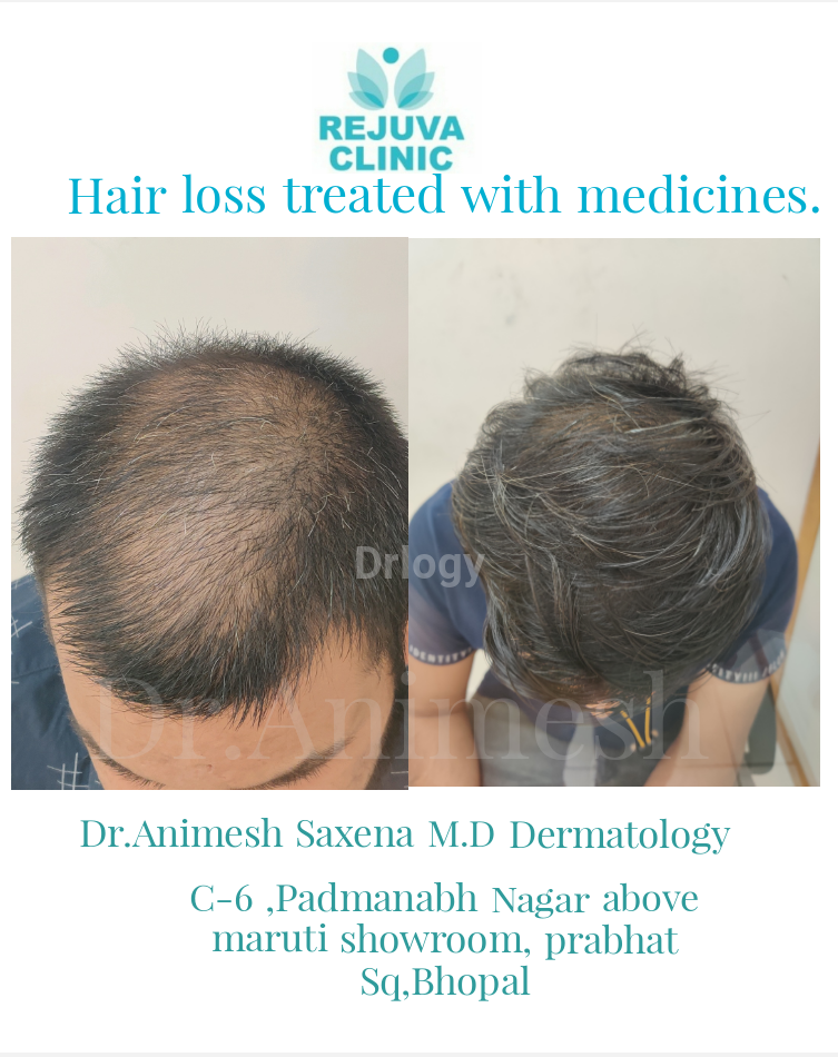 Rejuva Clinic Images/Photos, Padmanabh nagar,Subhash nagar, Bhopal