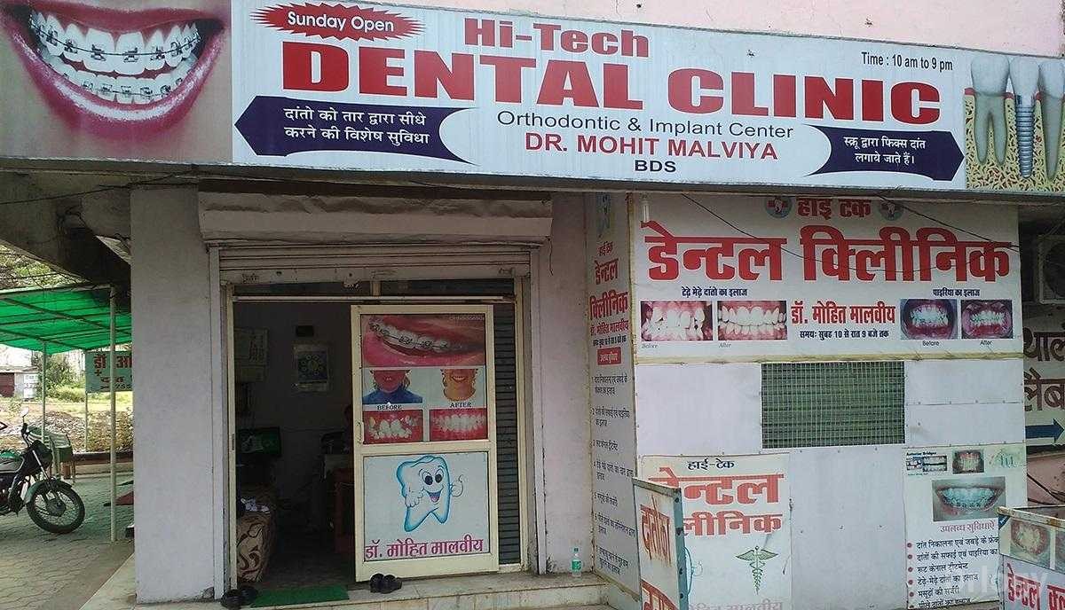 Hi-Tech Dental Clinic Images/Photos, North T.T. Nagar, Bhopal