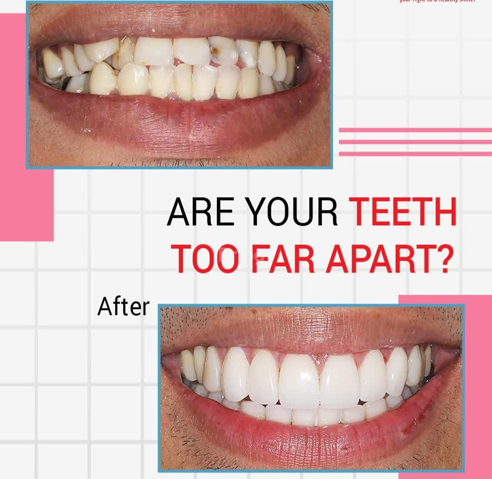 I Smile Dental Care - Channasandra Images/Photos, Channasandra, Bangalore I Smile Dental Care - Channasandra Images/Photos, Channasandra, Bangalore