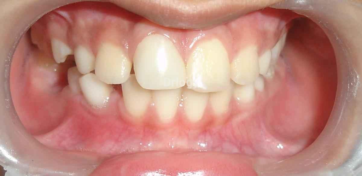Kids Smile Care Pediatric Dental Clinic Images/Photos, Bhatar, Surat