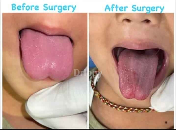 Happy Kid Dental Clinic Fortune Plaza, Khradi- Dr Pranil Survashe Images/Photos, Kharadi, Pune