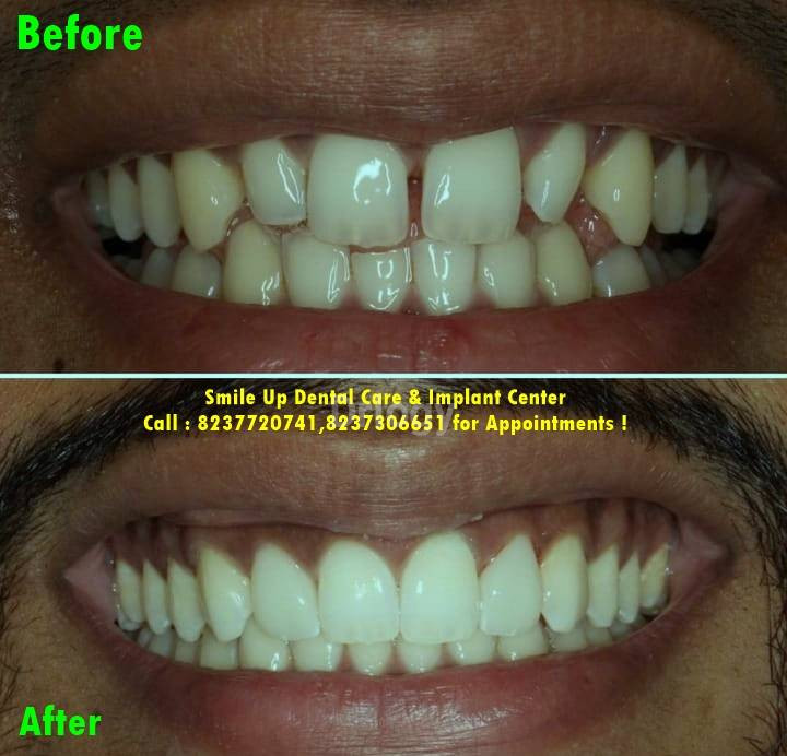 Smile Up Dental Care & Implant Center Images/Photos, Kharadi, Pune