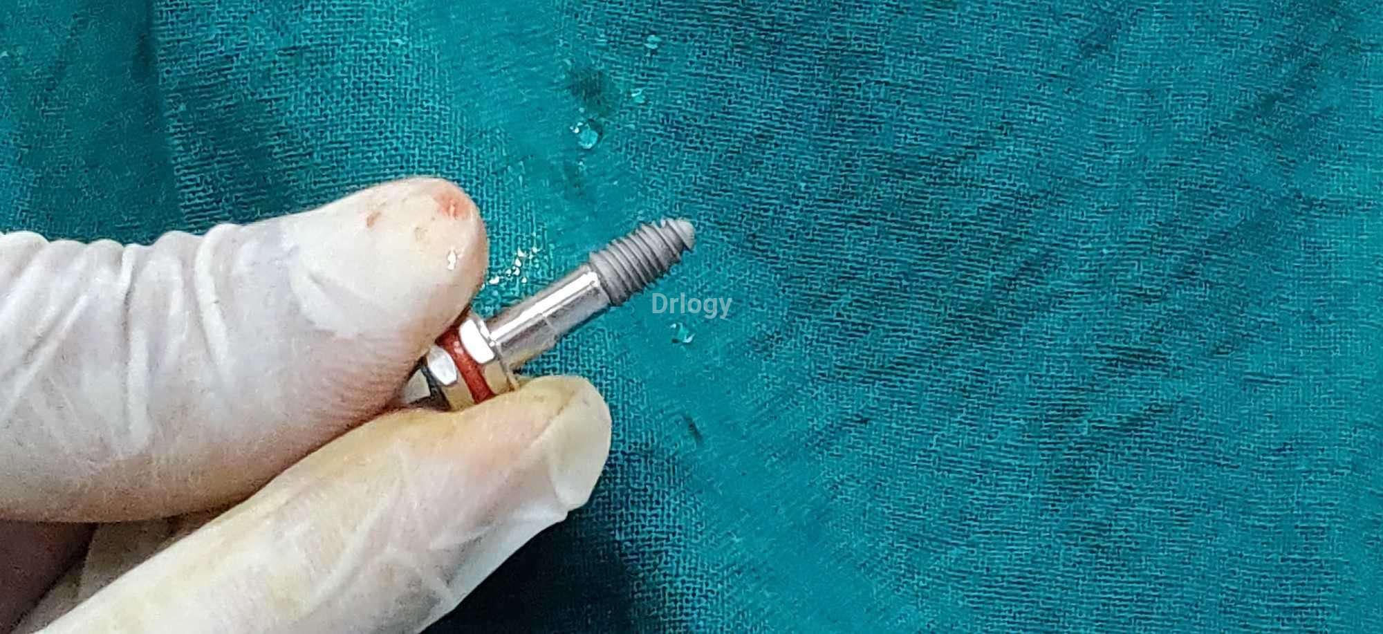 Oris Dental Care Images/Photos, Sadhu Vasvani Road, Rajkot