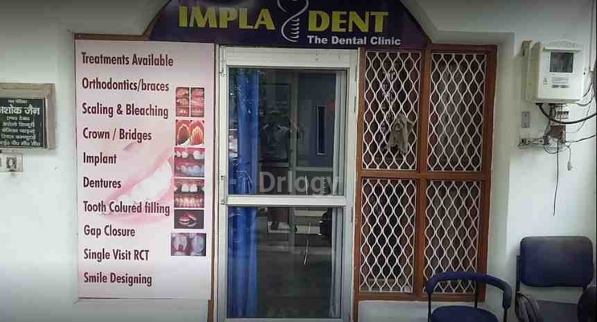 Impladent Images/Photos, Civil Lines, Prayagraj