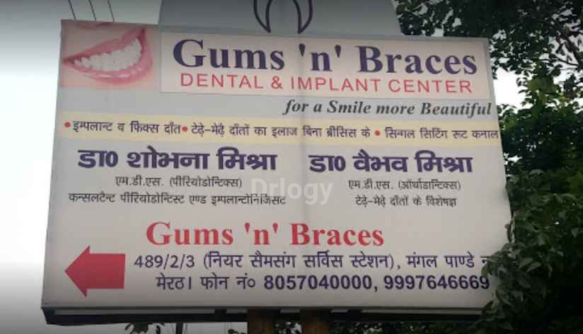 Gums 'N' Braces Dental & Implant Centre Images/Photos, Mangal Pandey Nagar, Meerut