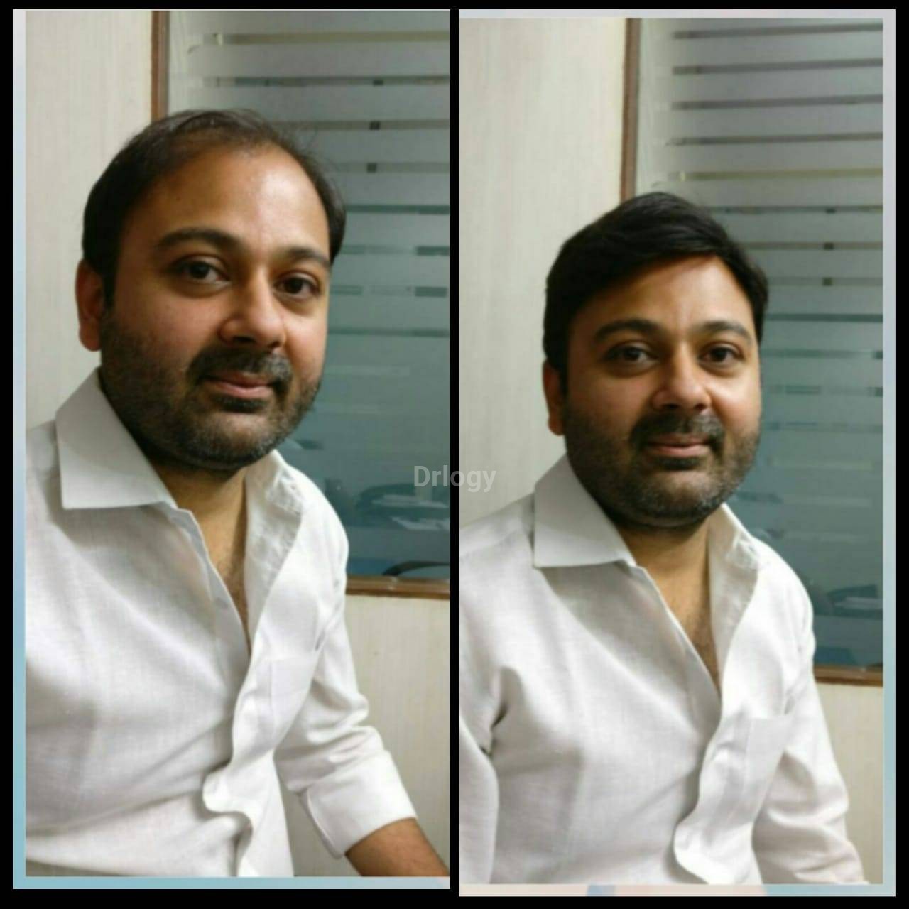 Astha Hair Clinic & Transplant Center Images/Photos, Kishan Para, Rajkot