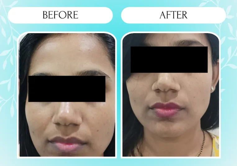 Bodysutra Clinique - Skin & Hair Clinic Images/Photos, Pimpri Chinchwad, Pune Bodysutra Clinique - Skin & Hair Clinic Images/Photos, Pimpri Chinchwad, Pune