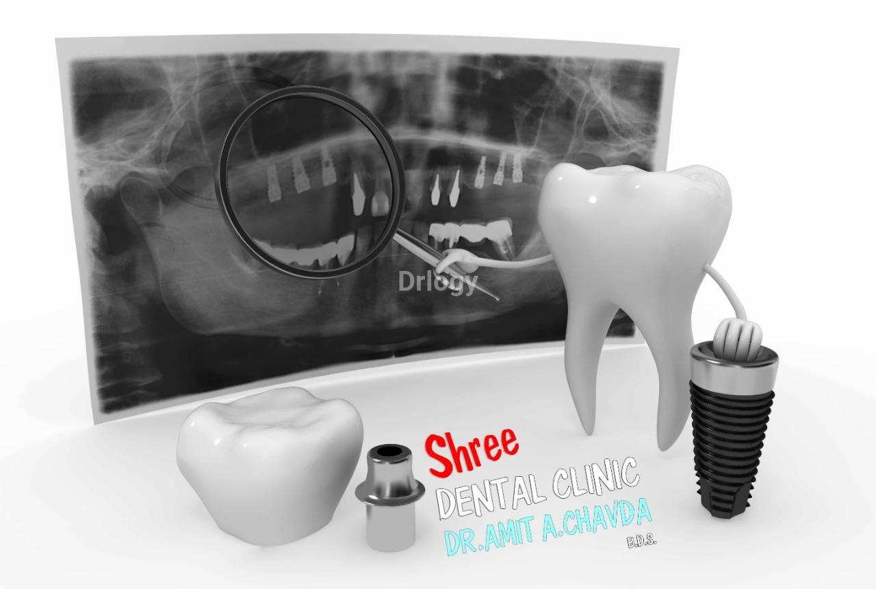 SHREE DENTAL CLINIC Images/Photos, P N Marg, Jamnagar