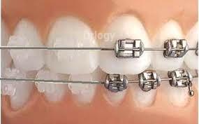 Smit Dental Clinic Images/Photos, Adajan, Surat