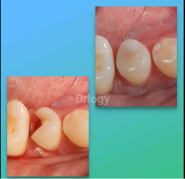 Glitter Dental Clinic Images/Photos, Hinjewadi, Pune