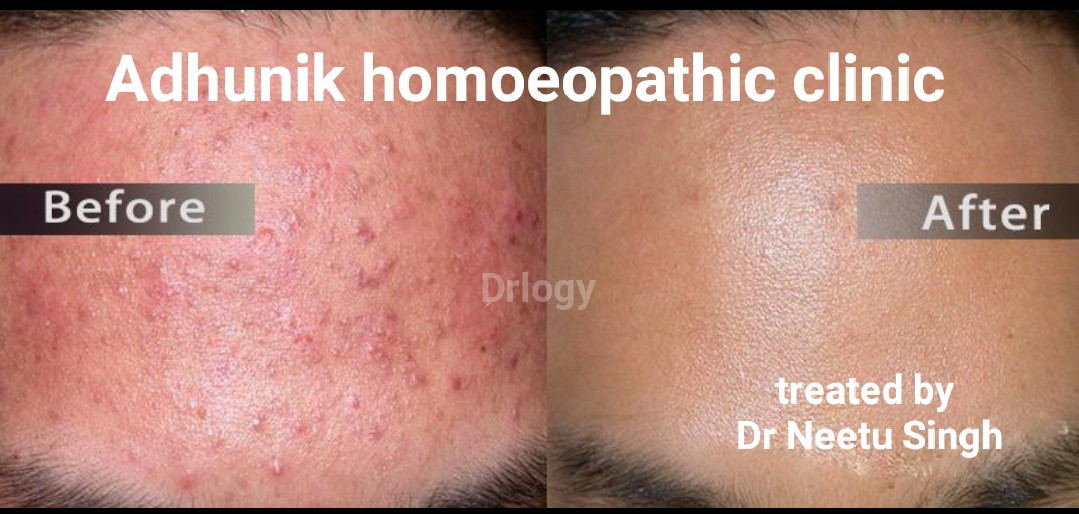 Adhunik Cure Homoeopathic Clinic Images/Photos, Rasulgarh, Varanasi