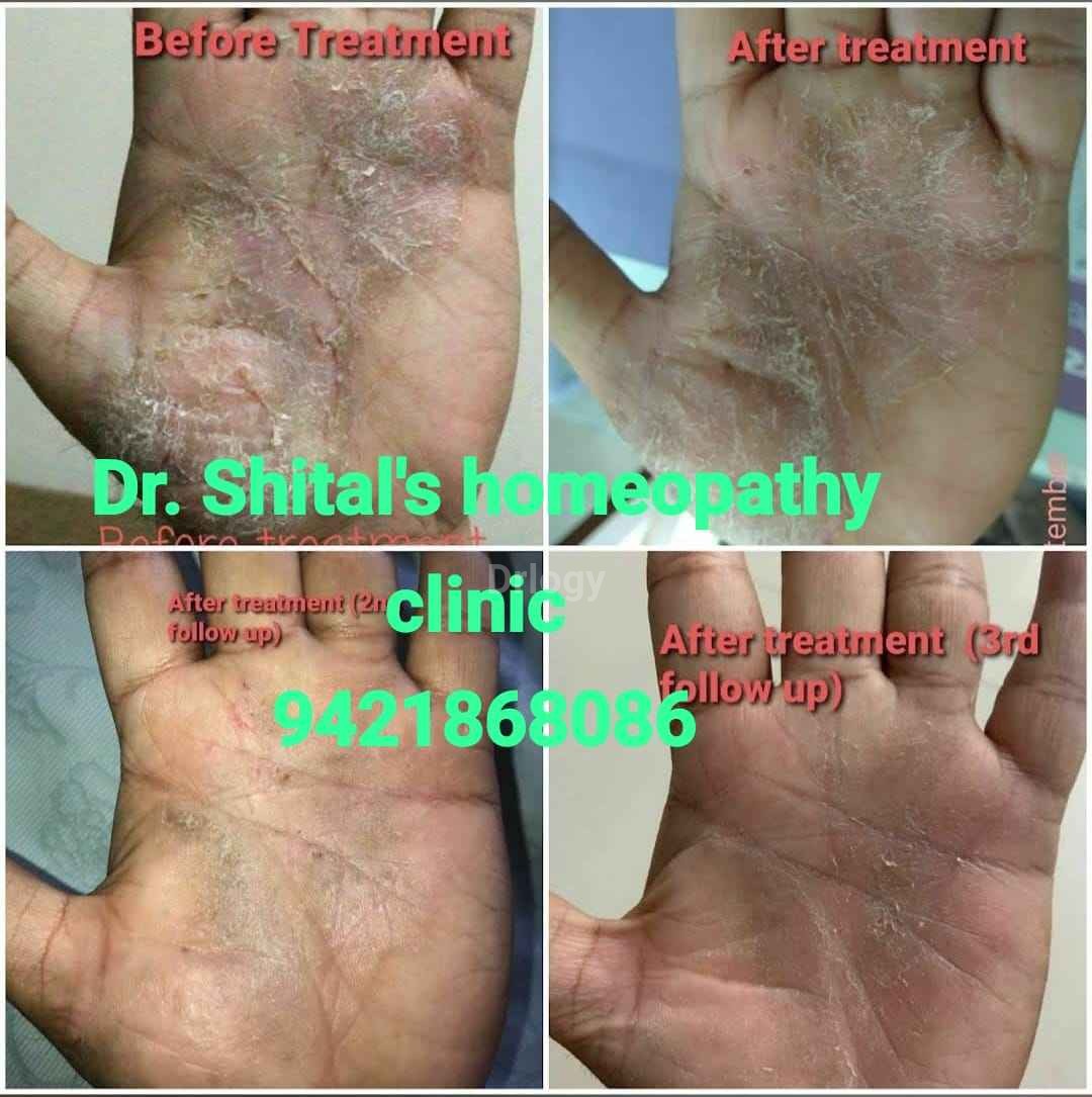 Dr. Shital'S Homeopathy Clinic Images/Photos, Wakad, Pune
