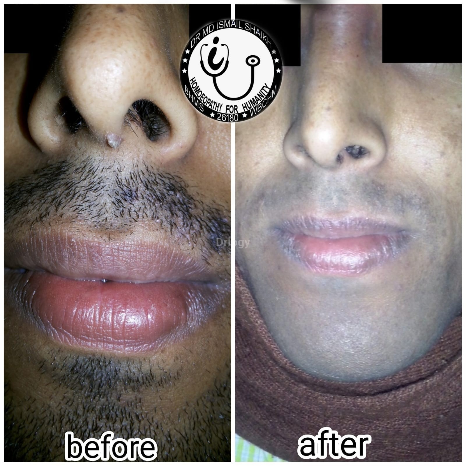 Dr Md Ismail Shaikh'S Homeopathy Clinic - Murarai, Birbhum Images/Photos, Bhadiswar, Birbhum