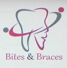 Bites and Braces in Bangalore