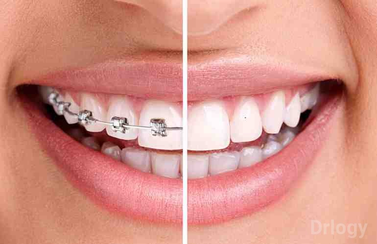 Choudhary Multi Speciality Dental Clinic in Bhopal