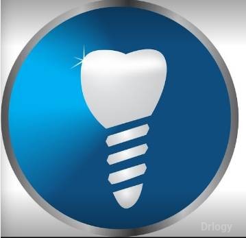 Face Dental Implant Centre in Hyderabad