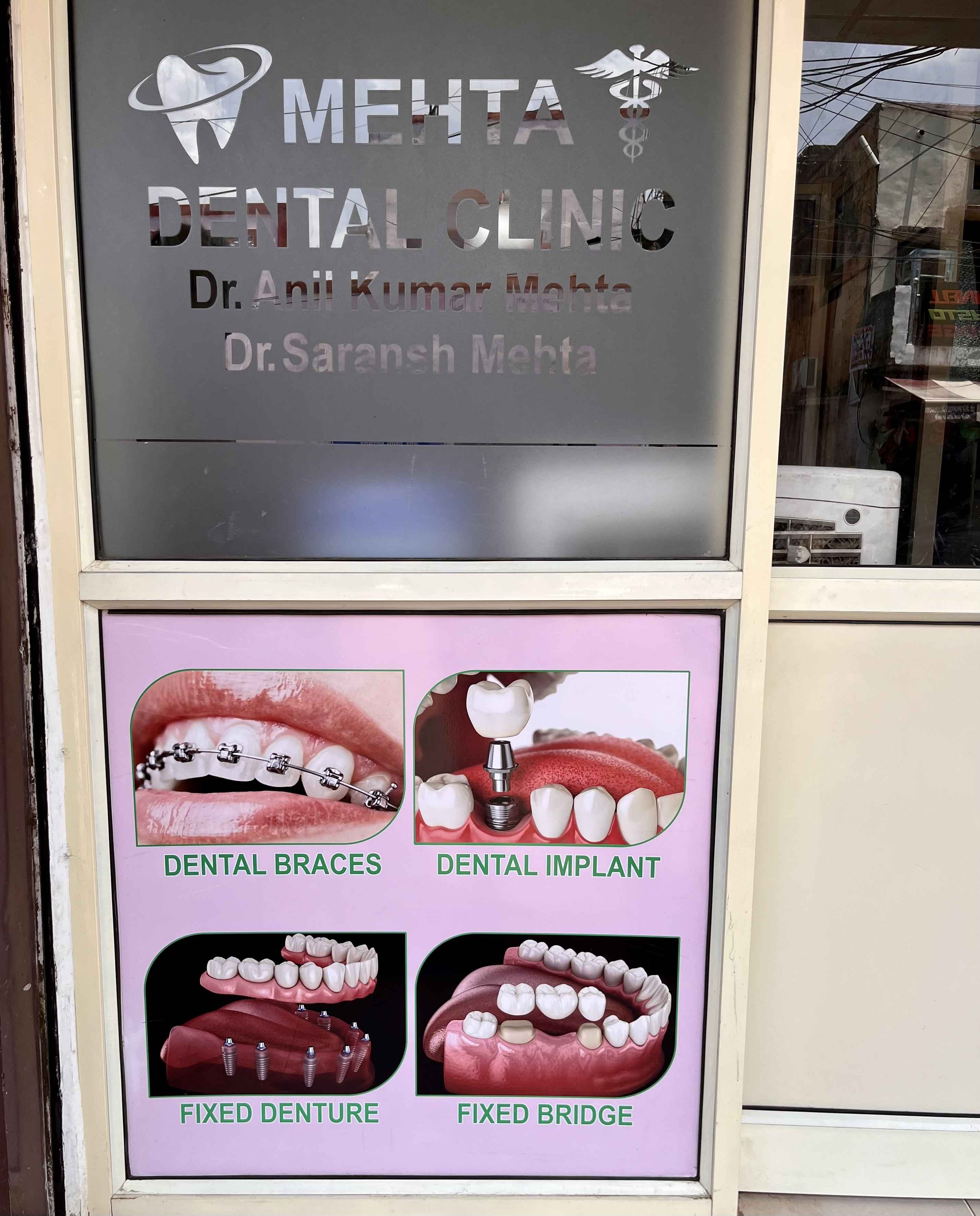 Mehta dentla clinic in Gwalior Mehta dentla clinic in Gwalior