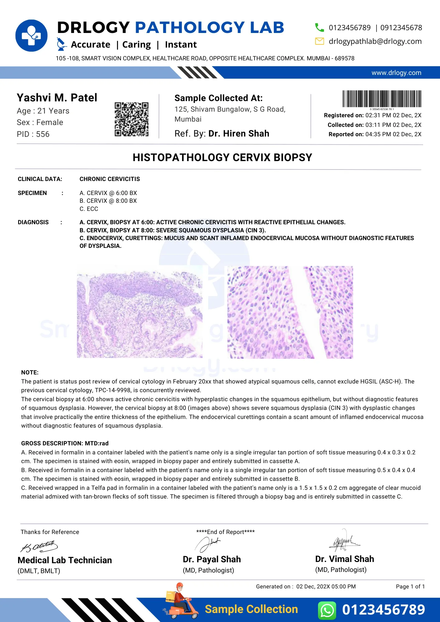 Histopathology Cervix Biopsy Test Report Format Example Sample Template - Drlogy Lab Report