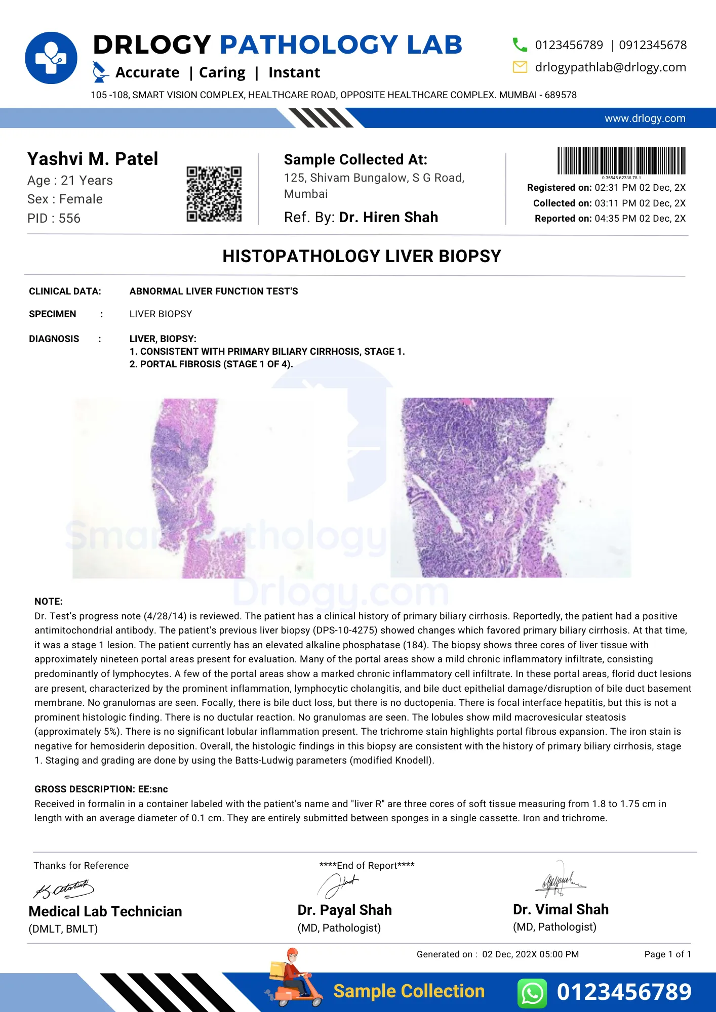 Histopathology Liver Biopsy Test Report Format Example Sample Template - Drlogy Lab Report