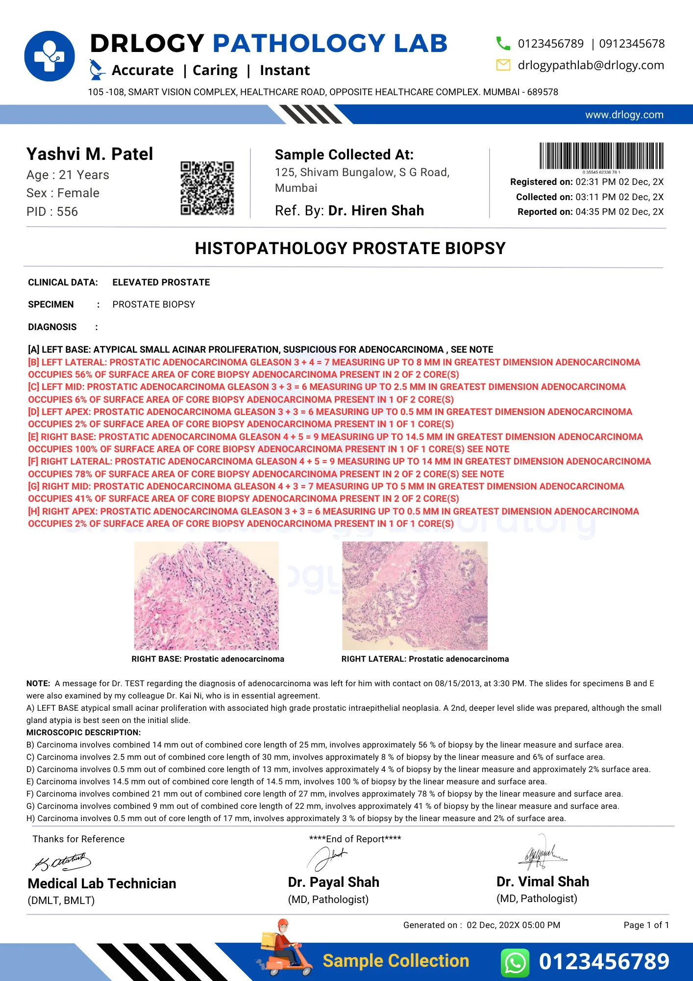 Histopathology Prostate Biopsy Test Report Format Example Sample Template - Drlogy Lab Report