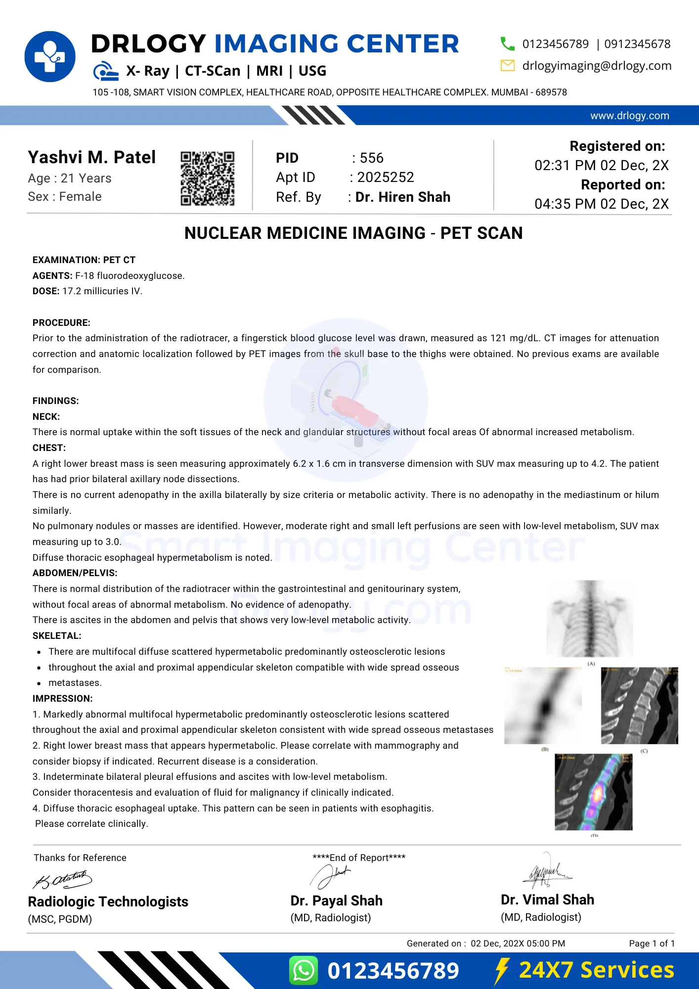 Nuclear Medicine Imaging Report Format Example Sample Template - Drlogy Lab Report