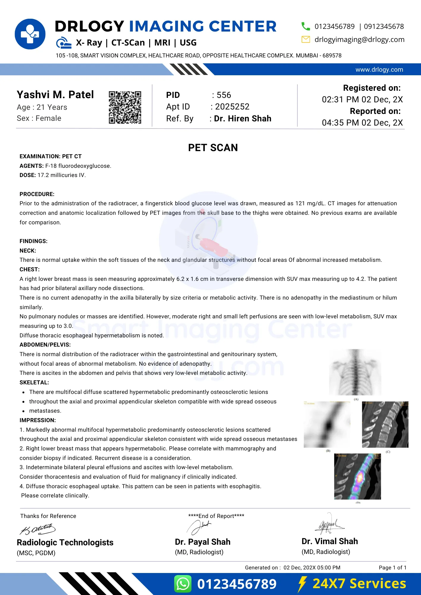 pet scan essay