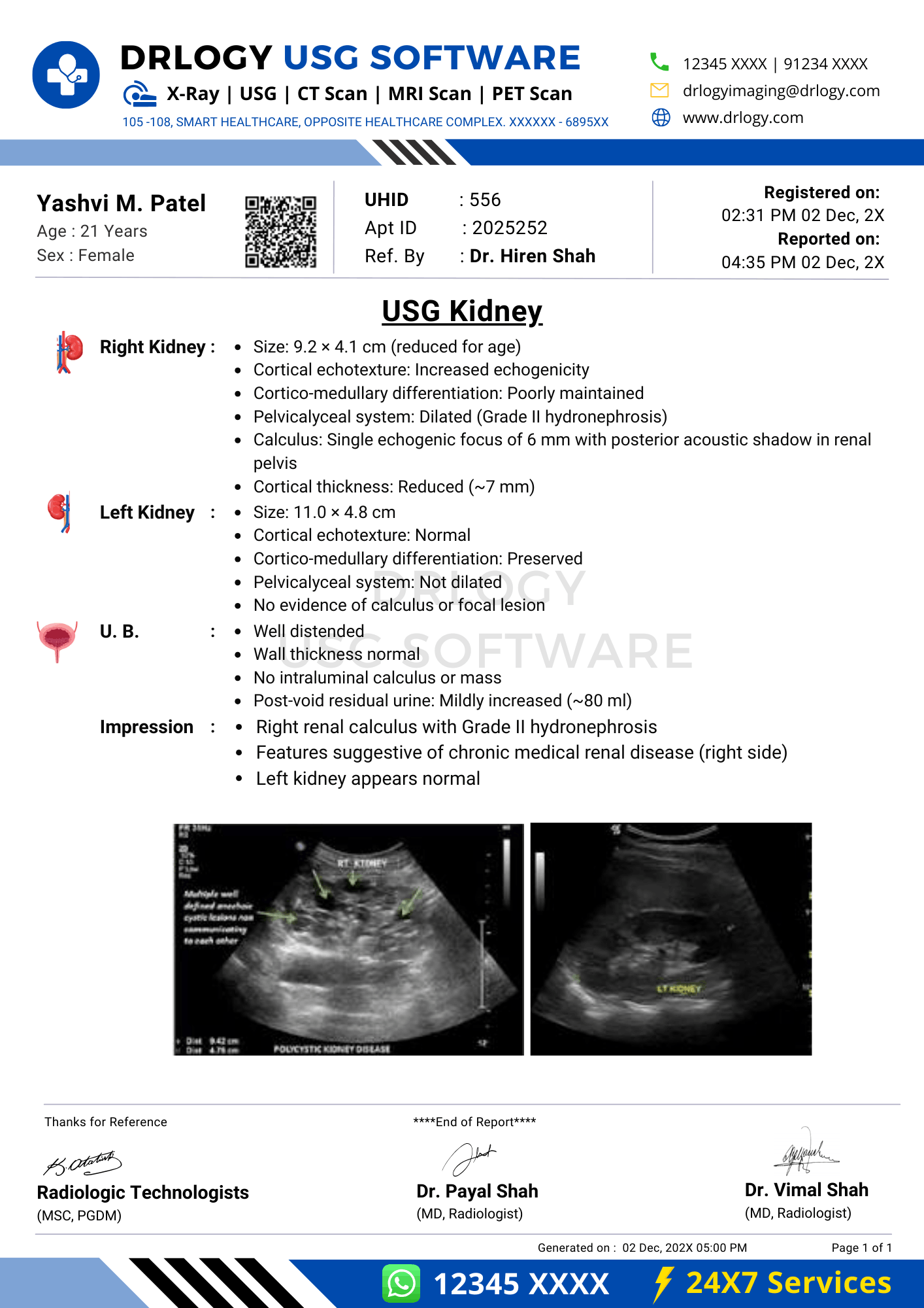 Kidney ultrasound report format sample using Drlogy USG Reporting Software