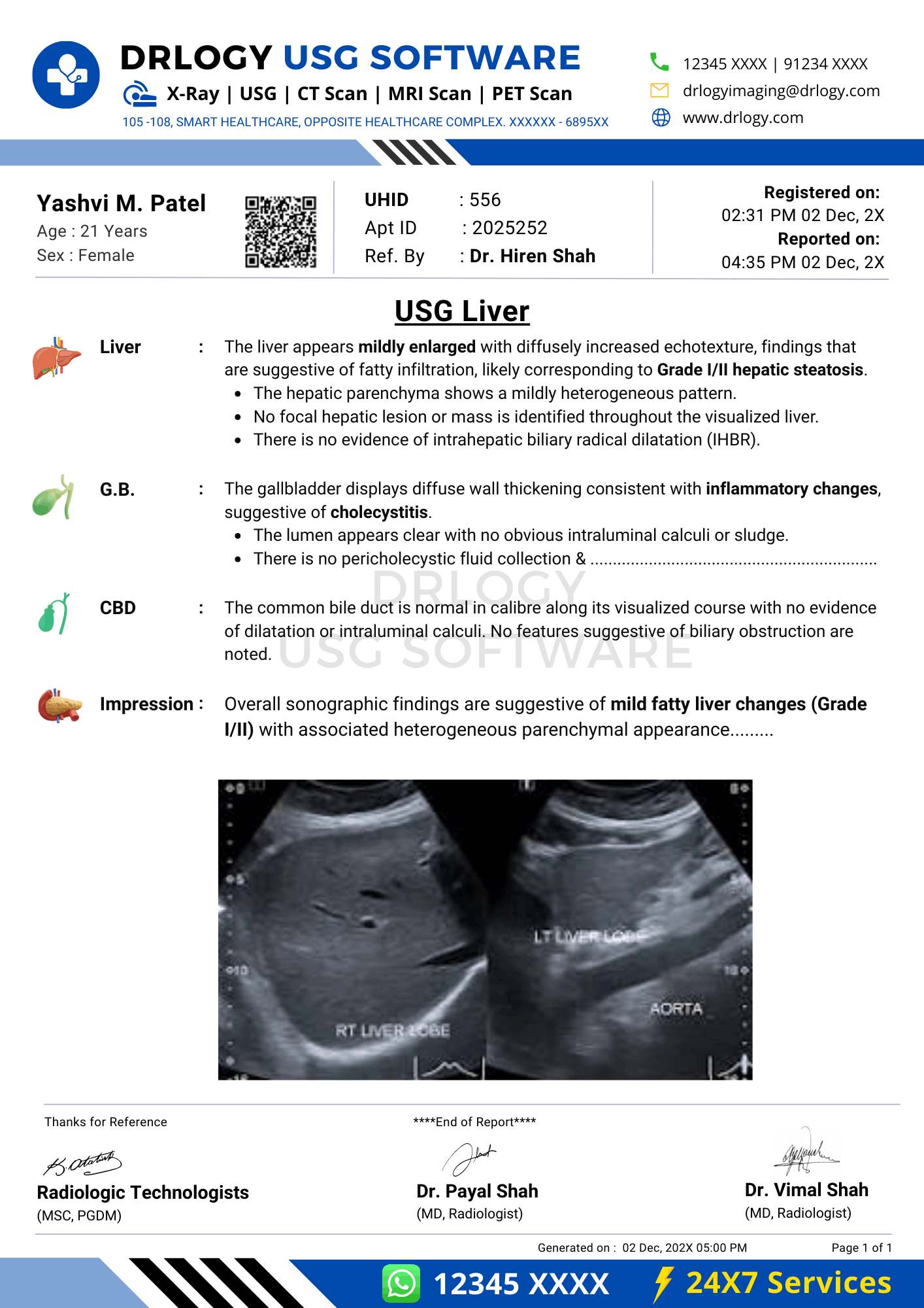 Liver USG report format example in Drlogy Plus USG reporting software