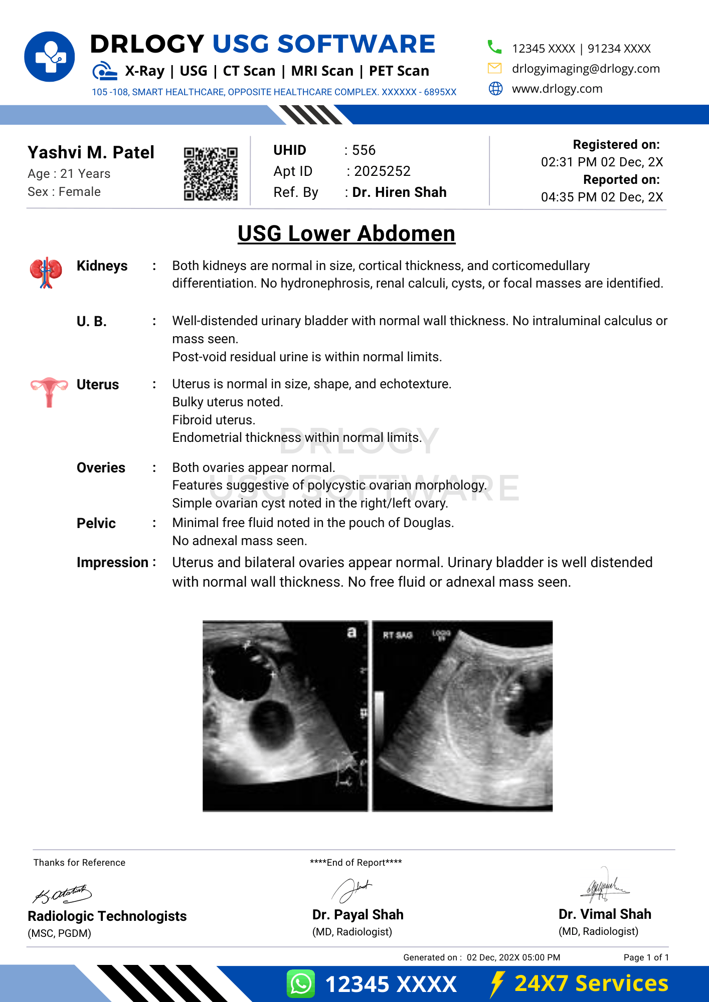 Lower abdomen ultrasound report format example using Drlogy USG Reporting Software