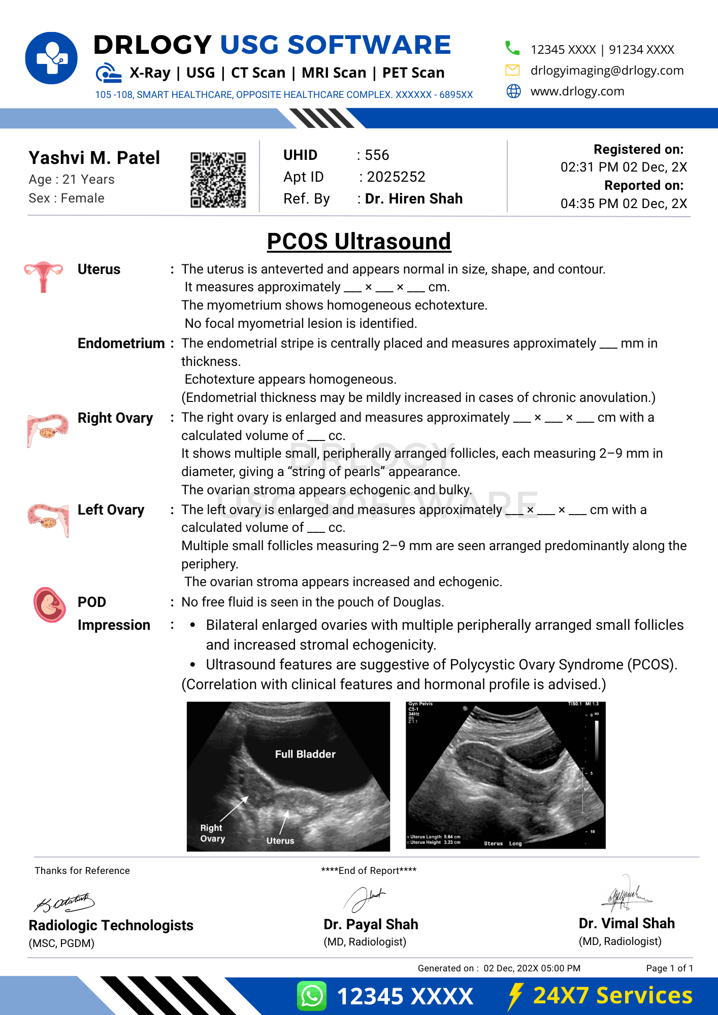 PCOS ultrasound report format sample generated in Drlogy USG Reporting Software